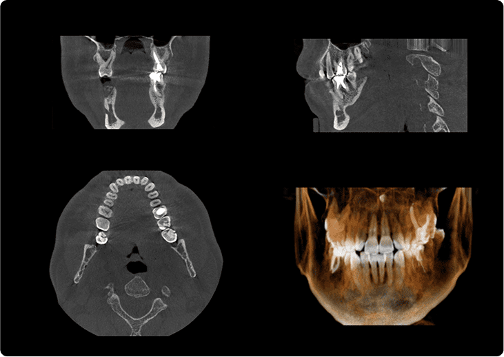 口腔外科認定医が在籍、歯科用CT完備で難症例にも対応可能です。