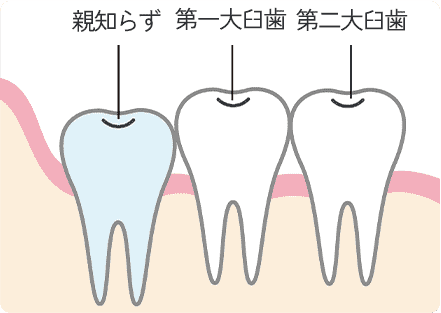 正常なタイプ