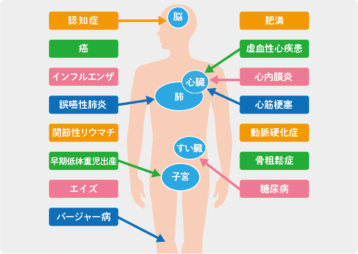 歯周病で早産に!?