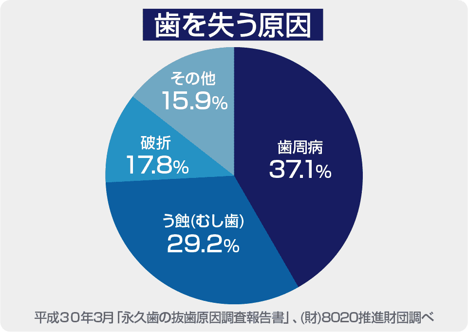 歯が抜ける原因第1位は歯周病